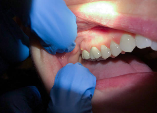 Best Emergency Gum Treatment in Ewa Villages, HI