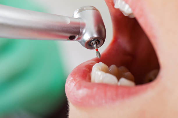 Best Emergency Treatment for Dental Infections or Abscesses in Ewa Villages, HI